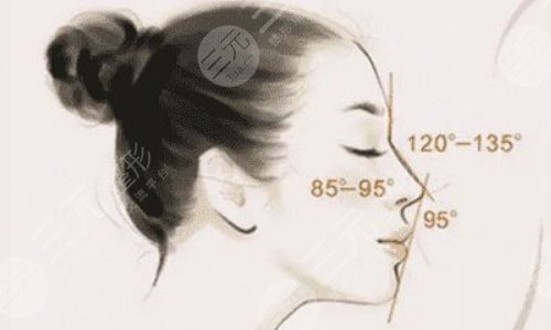 耳软骨隆鼻的恢复期是多久?