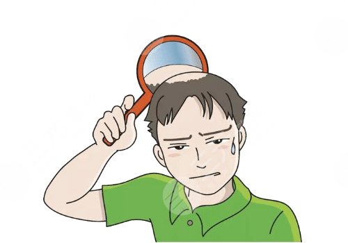 什么治疗脱发果好?