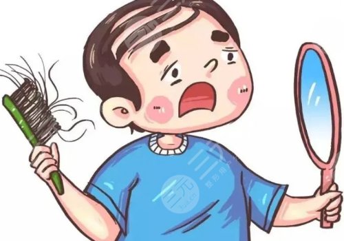 什么治疗脱发果好?