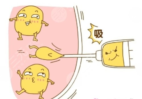 减肥抽脂对身体好不好?