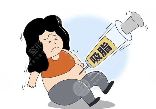 减肥抽脂对身体好不好?