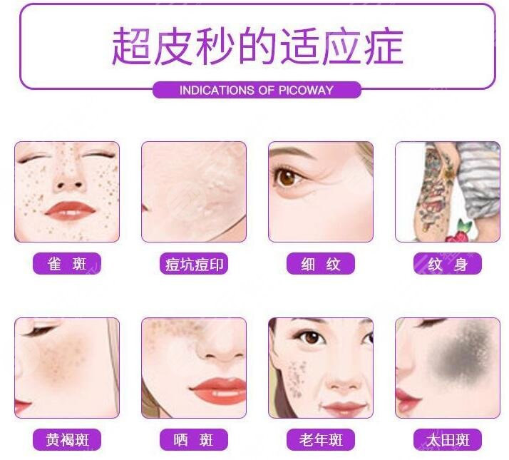 市面上的祛斑美白医美项目
