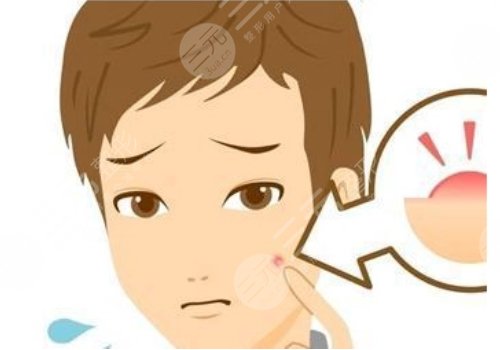 脸上红色痘印怎么消?