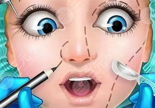 假体隆鼻整形费用是多少?