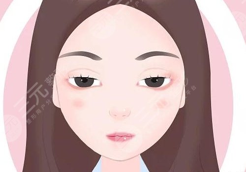 上睑下垂矫正手术多少钱?