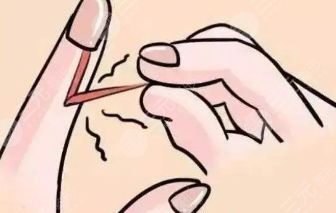 手脚脱皮