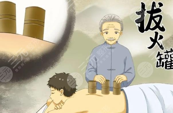 拔罐
