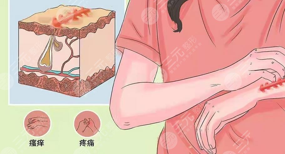 脸上有疤痕怎么去除?