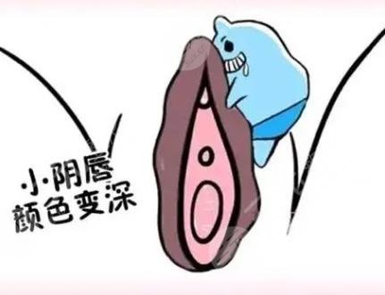 激光漂红私密粉嫩