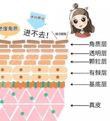 去角质