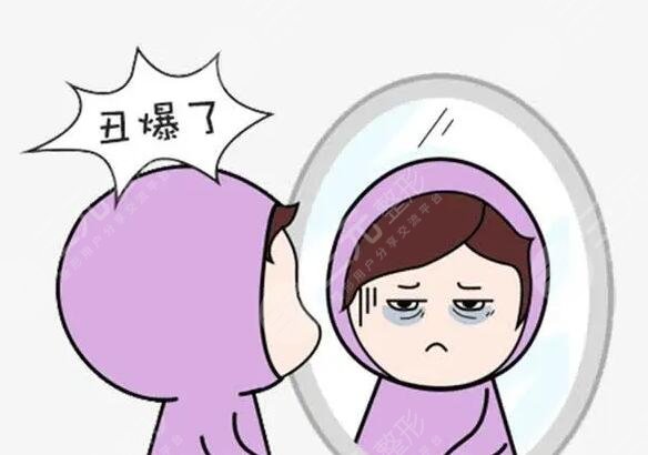 医美整形手术改善黑眼圈