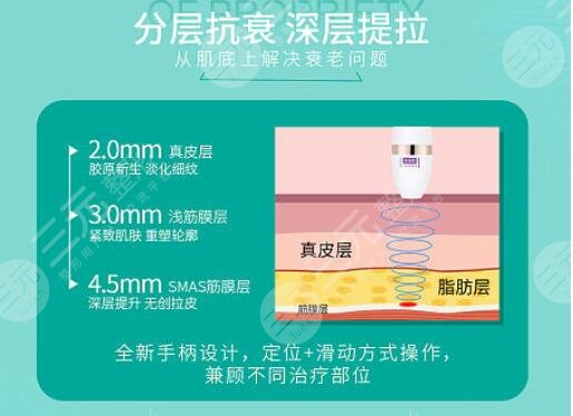 超声炮的适应人群