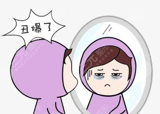 黑眼圈很重怎么去除有？来教你几招应对熊猫眼，变得靓丽有神~