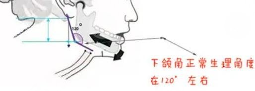 下颌角