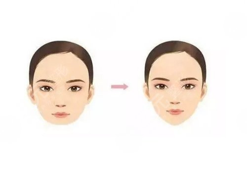 垫下巴整形多少钱?