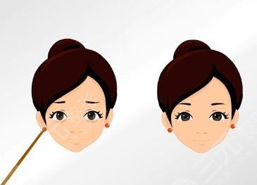 眼部吸脂
