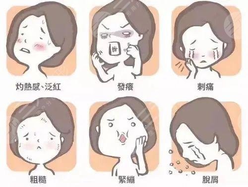 出现痤疮的几种原因