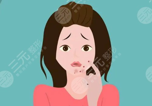 脸上长痘印了怎么办？如何消除？