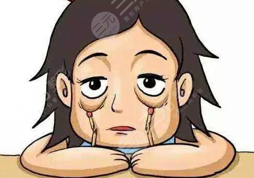 自体脂肪填充下眼睑凹陷有哪些优势和弊端?
