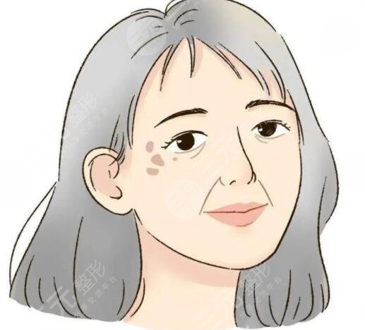 长老年斑吃什么好?