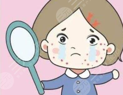 青春痘疤痕
