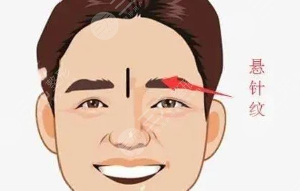 额头悬针纹