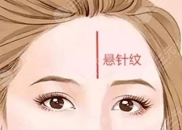 额头悬针纹