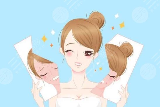 化妆改善