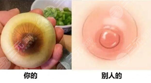 如何让乳头变红?