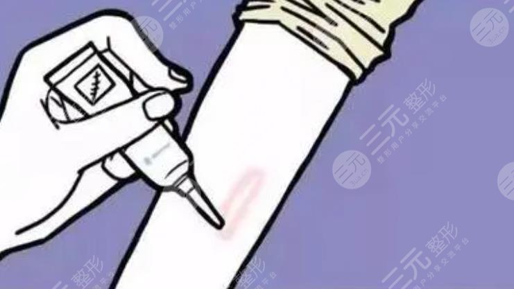 增生疤痕