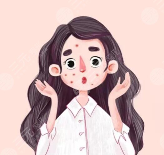 复合彩光去痘几次有？复合彩光去痘的原理和果解析，网友打卡后反馈~