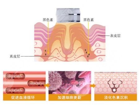 皮肤美白的日常护理