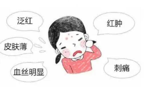 有红血丝的皮肤怎么保养才好呢?