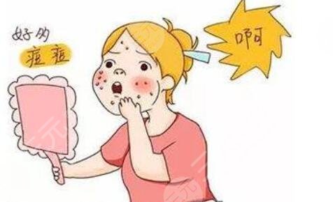 祛痘