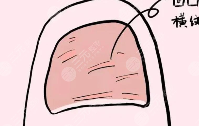 指甲凹凸不平