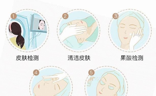 芯丝翠果酸换肤
