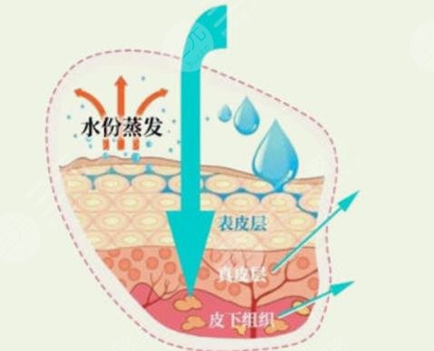芯丝翠果酸换肤