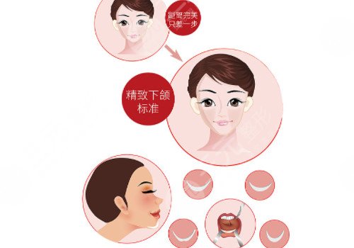 硅胶垫下巴多少钱?