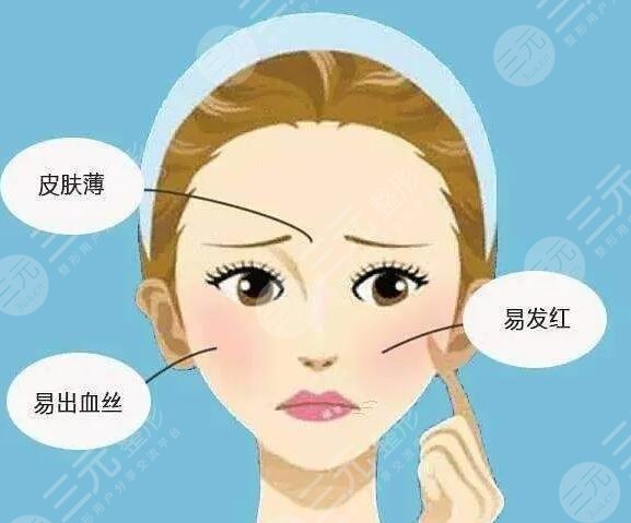 红血丝