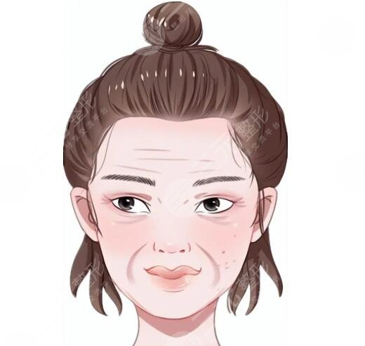 热玛吉抗衰老可能存在的副作用有哪些？果能维持多久？注意事项要做好！