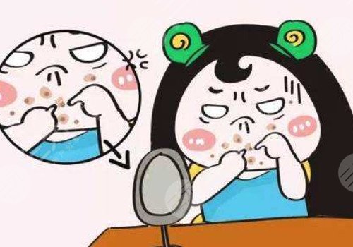 脸上长痘印如何消除?