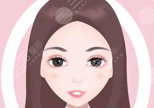 面部自体脂肪填充可以维持多久？