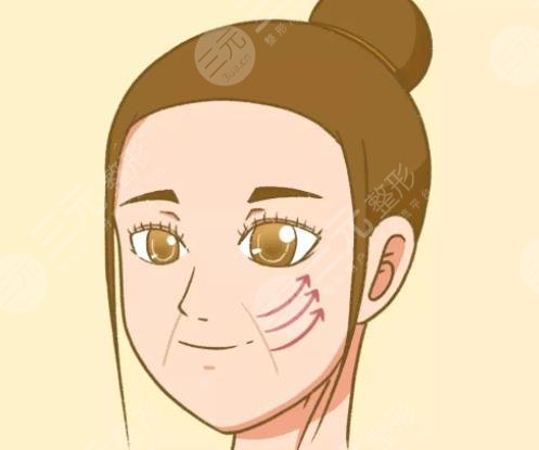皮肤松弛