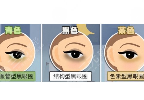 去黑眼圈后的护理