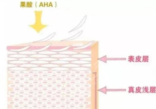 果酸美白果好吗?