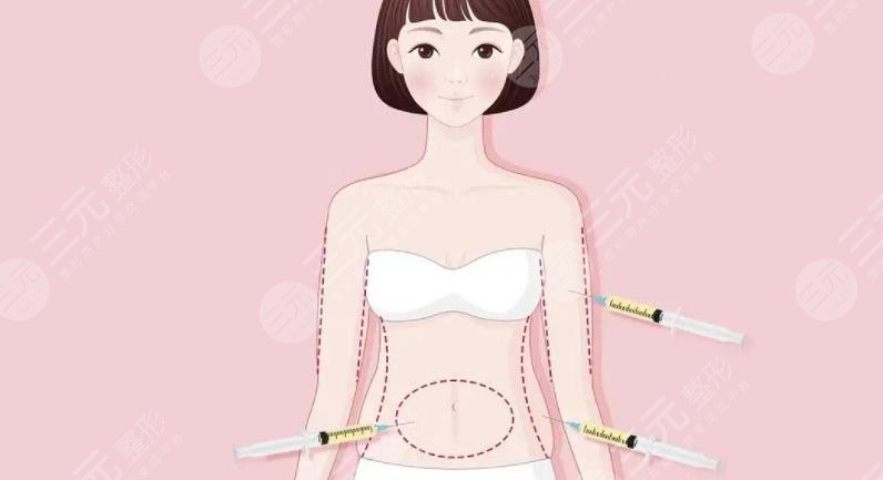 手臂吸脂
