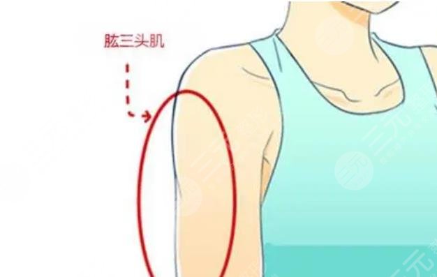 手臂吸脂