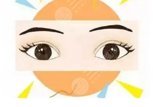 三点定位双眼皮能维持多久？
