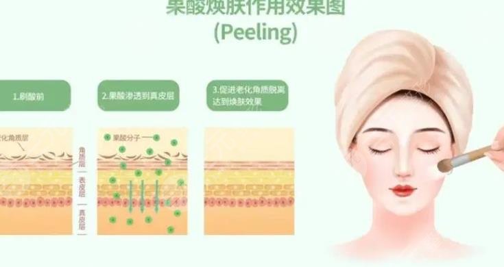 果酸