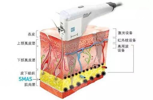 红血丝皮肤用什么护肤品好?